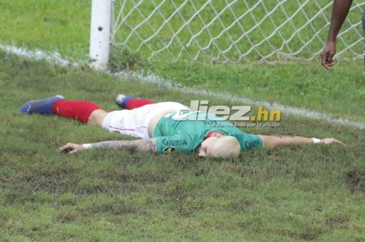 NO SE VIO EN TV: Dos jugadores se pintaron el cabello de azul y blanco; Olimpia propinó goleada