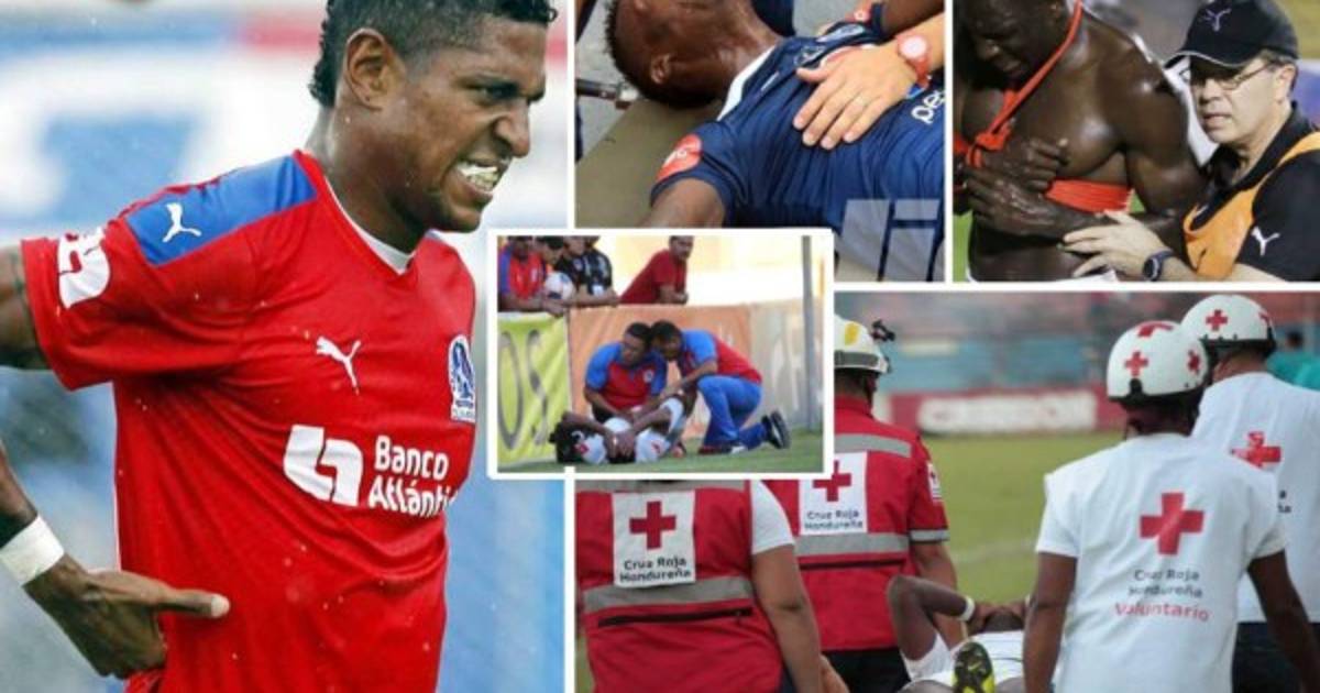 ¡Fracturas! Las graves lesiones que se han dado en el fútbol hondureño