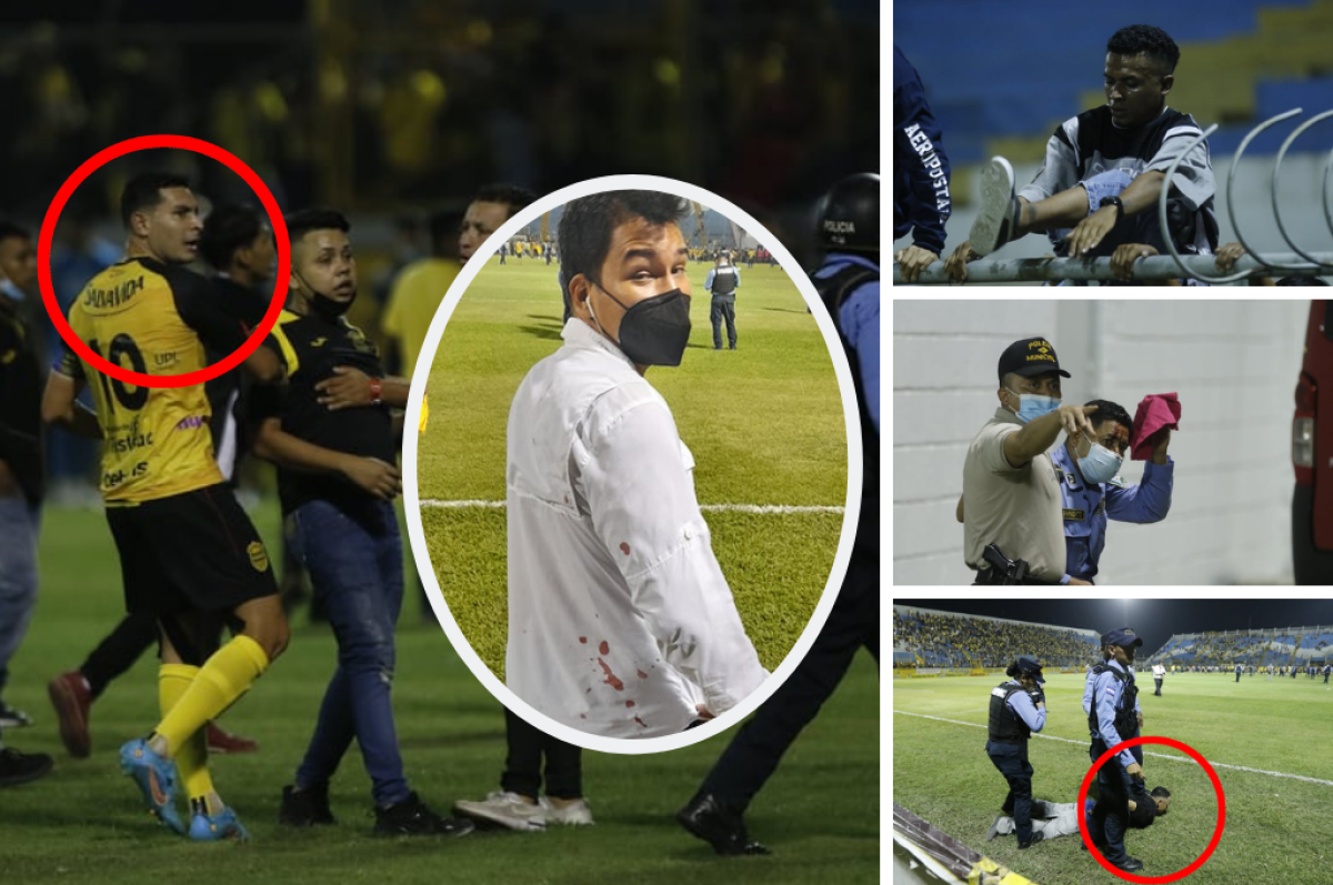 Las fotos del drama en el Morazán: Jhow Benavídez pidiendo calma, policía y aficionados heridos en el Clásico Real España-Marathón