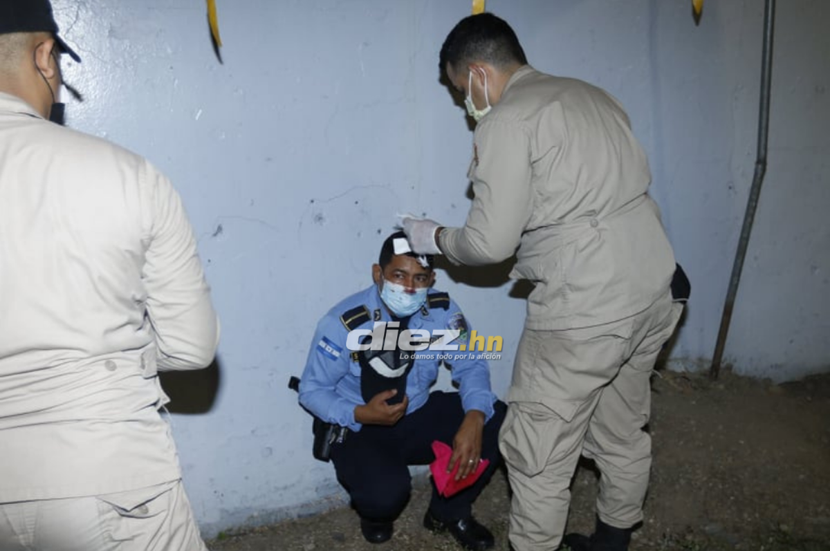 Las fotos del drama en el Morazán: Jhow Benavídez pidiendo calma, policía y aficionados heridos en el Clásico Real España-Marathón