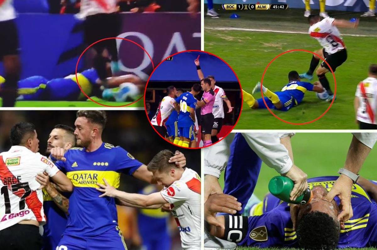 Patadón en el rostro y zafarrancho en La Bombonera: la brutal agresión en la cara a futbolista de Boca Juniors