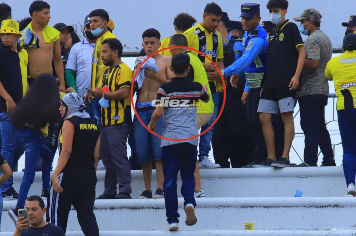 ¡Al descubierto! Salen a la luz las inéditas y claras imágenes del rostro del agresor en el Olímpico en la final de Honduras