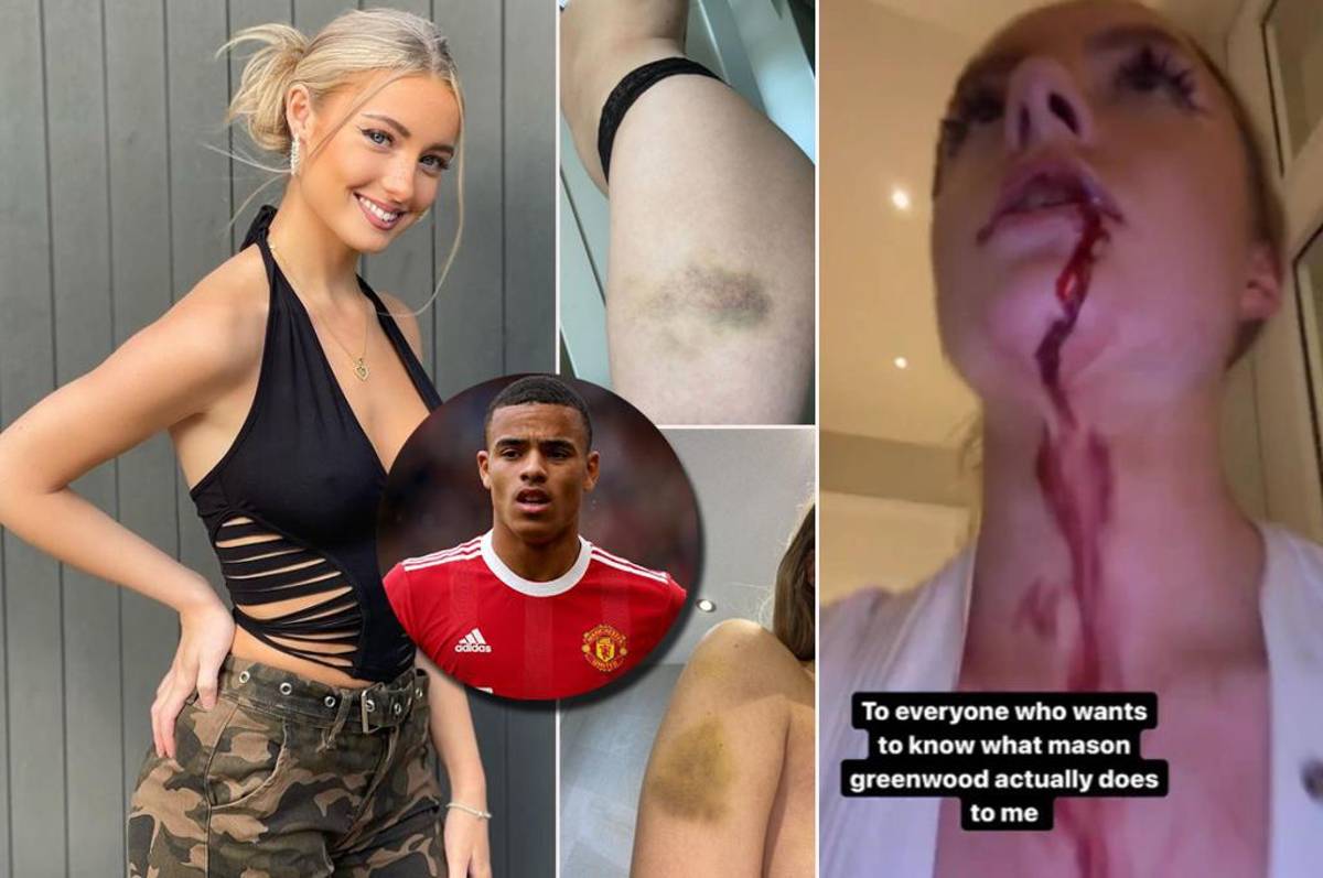 El calvario Greenwood tras ser acusado de violación: Cristiano le dio la espalda, eliminan su camisa y no tiene más ingresos