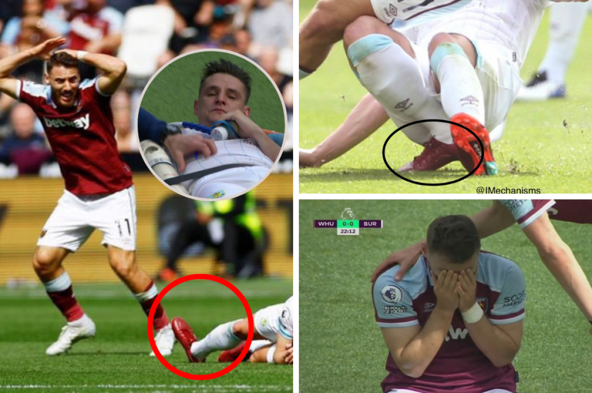 ¡No apto para sensibles! Así quedó el pie: La terrorífica lesión de Ashley Westwood que dejó a varios futbolistas llorando