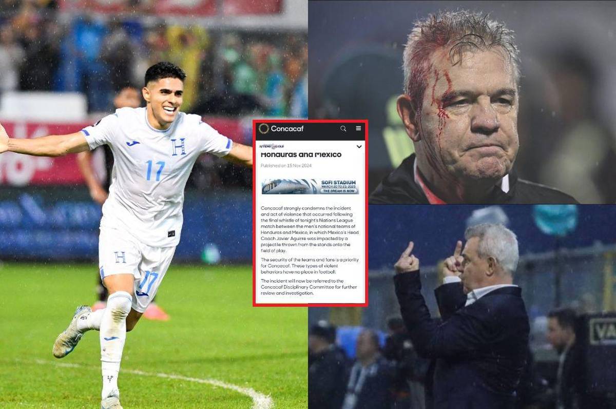 Concacaf emite comunicado por agresión a Javier Aguire ¿Qué castigos puede recibir Honduras?