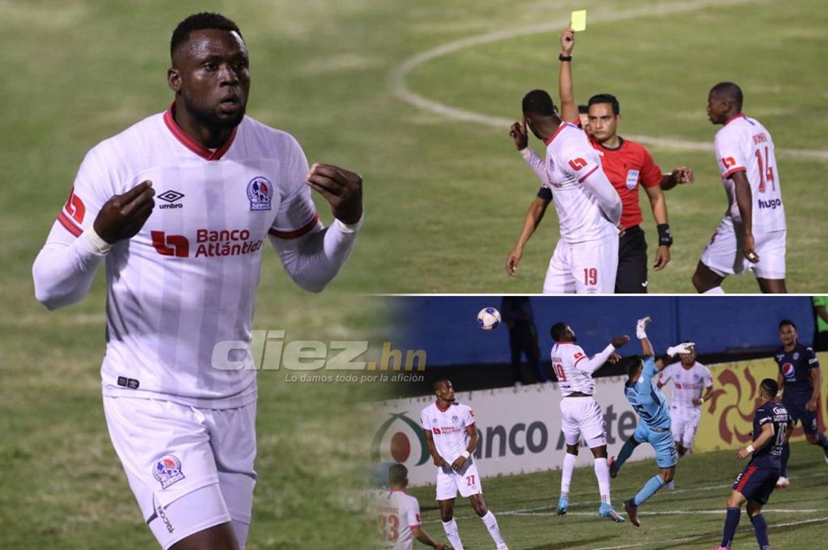 Arboleda, tras el gol anulado a Olimpia: ‘‘Aquí ya no podemos ni hablar porque te castigan, ellos se equivocan y pareciera que el equivocado es uno’’