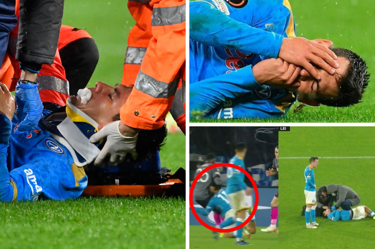 Terrible: Así quedó el rostro del Chucky Lozano tras un nuevo choque con la cabeza, salió en camilla y con collarín