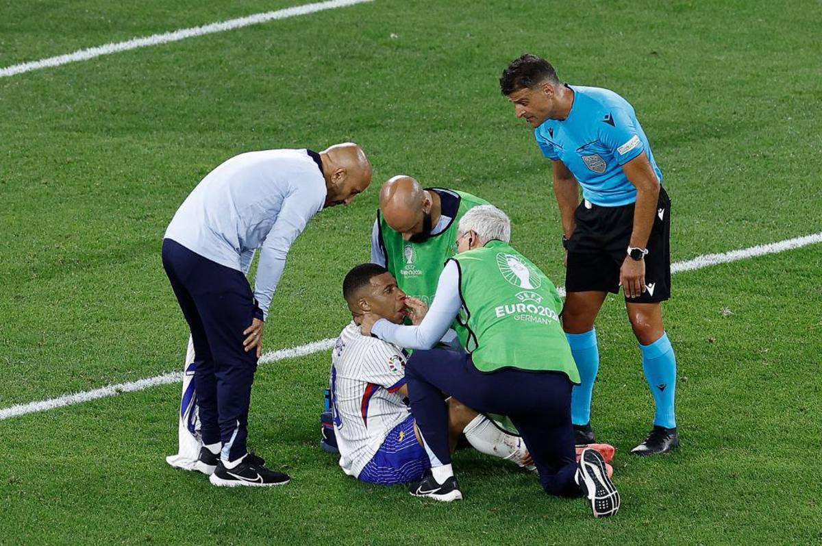 Mbappé se rompe, dardo de MisterChip a Kylian y Griezmann terminó lleno de sangre en el debut de Francia en la Eurocopa