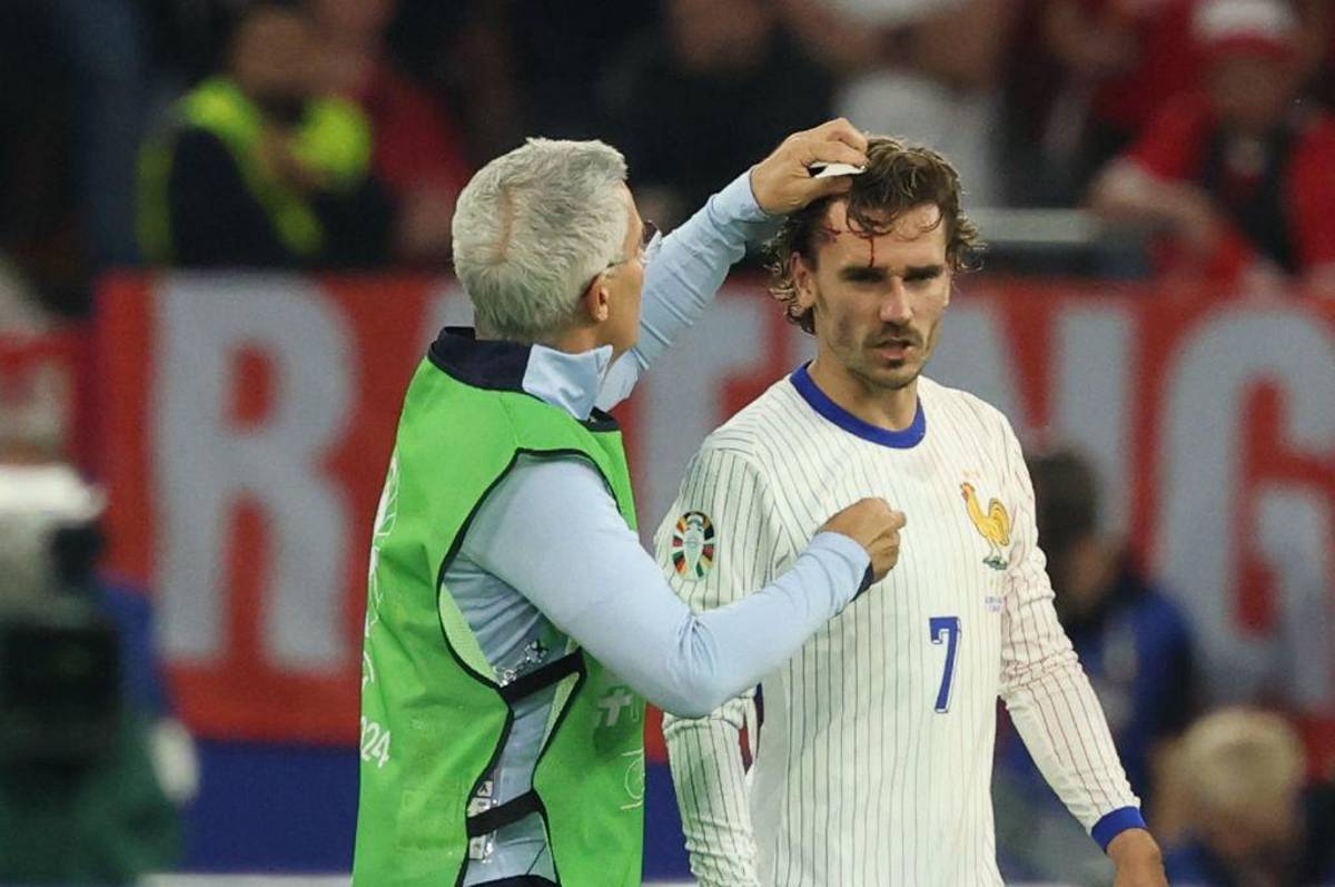 Mbappé se rompe, dardo de MisterChip a Kylian y Griezmann terminó lleno de sangre en el debut de Francia en la Eurocopa