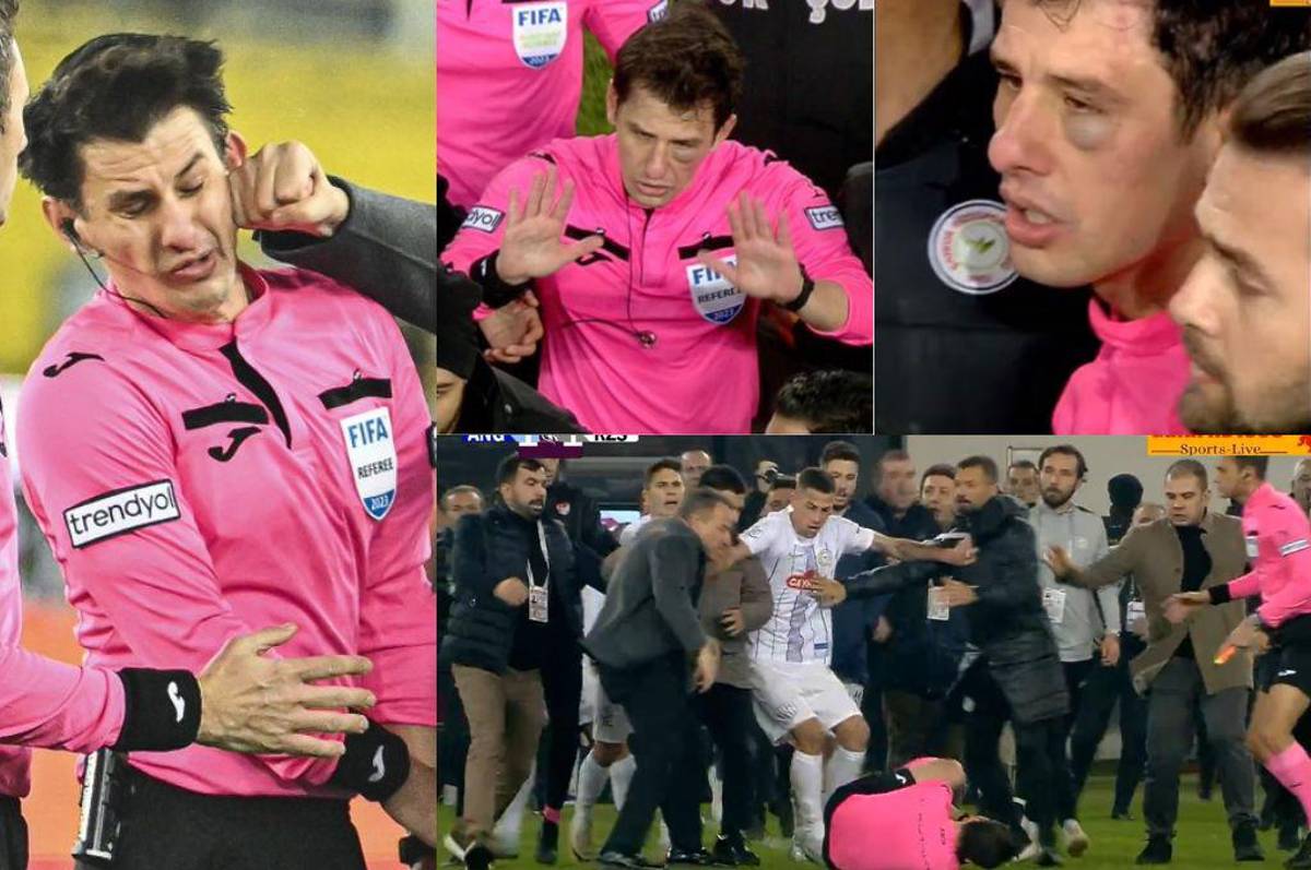 Con el ojo morado y pateado en el suelo: así quedó el árbitro tras ser golpeado por el presidente y jugadores de un equipo turco