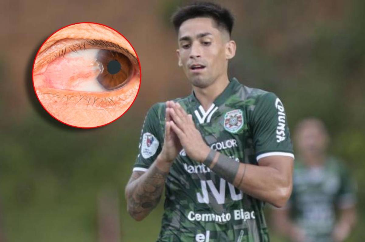 La extraña enfermedad que sufre el argentino Juan Vieyra que le complicará jugar en el 2023: trastoca su futuro