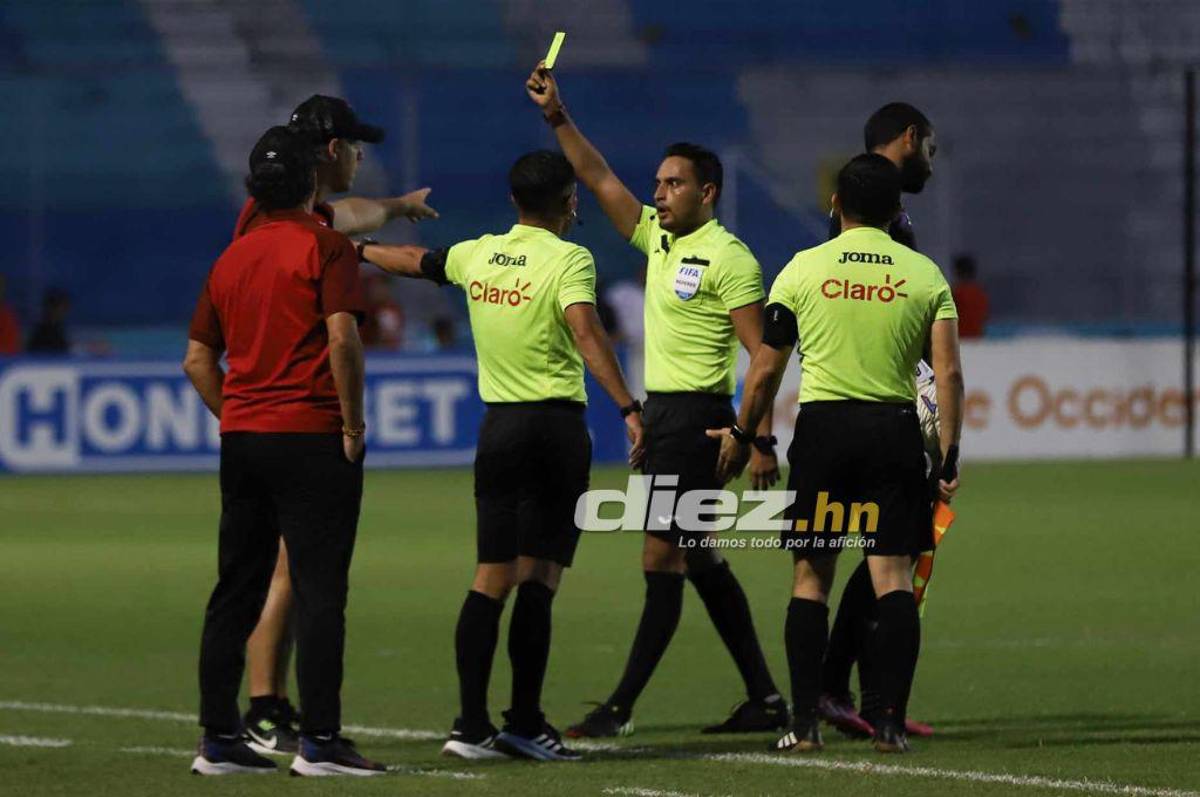 El descartado de Troglio, el duro golpe que recibió Arboleda, la pincelada de Alexy Vega y la belleza que invadió el Chelato Uclés