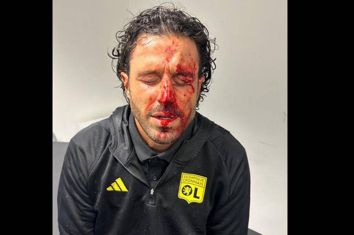 Le destrozaron la cara al entrenador del Lyon: hinchas de Marsella apedrearon el bus y esta ha sido la decisión de la Ligue 1