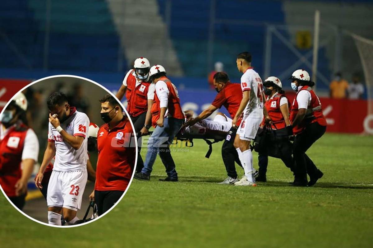 ¡Olimpia pierde a Jorge Álvarez por dos semanas tras sufrir una fractura en su nariz!