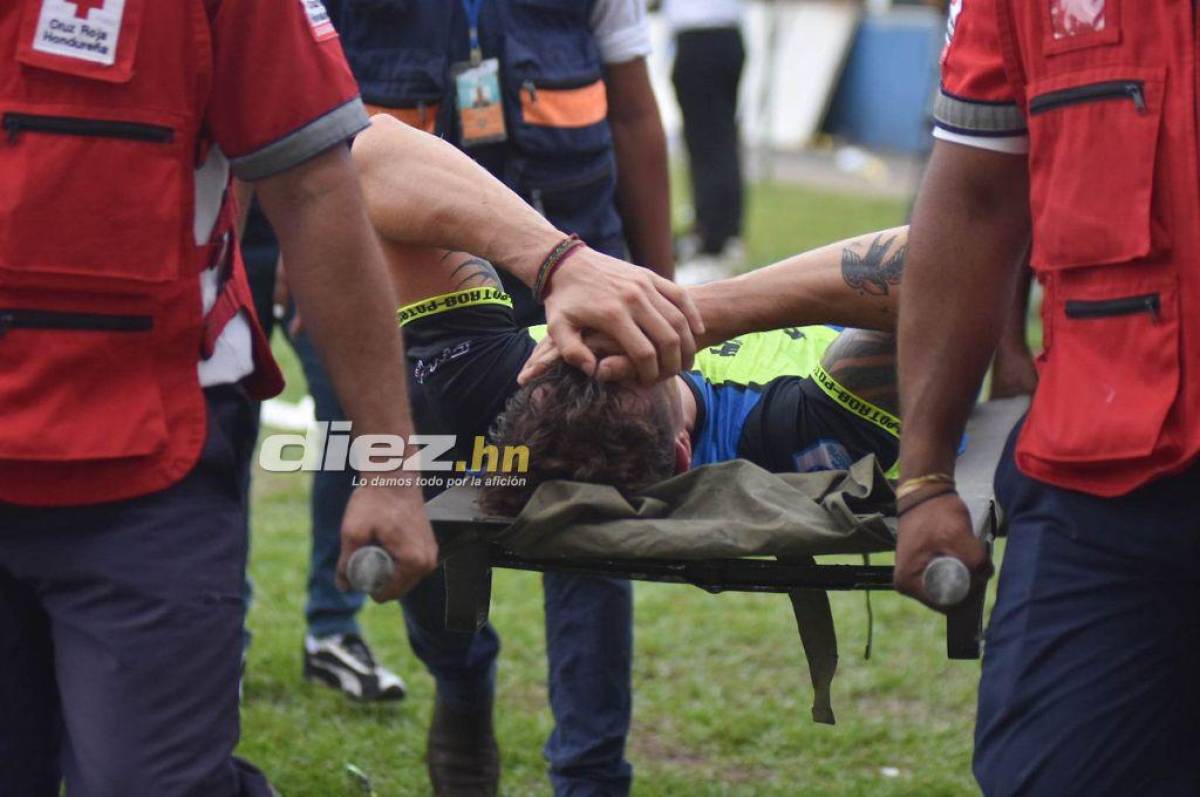 Baja de peso en los Potros: Santiago Molina sufre rotura de ligamento cruzado y se pierde la gran final