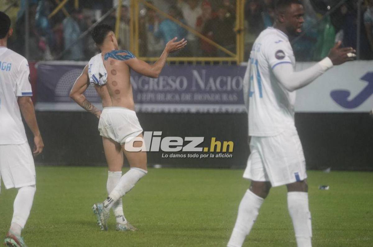 Bronca entre jugadores, el festejo de Honduras tras vencer a México y el feo gesto de Javier Aguirre, quien sufrió un corte en la cabeza