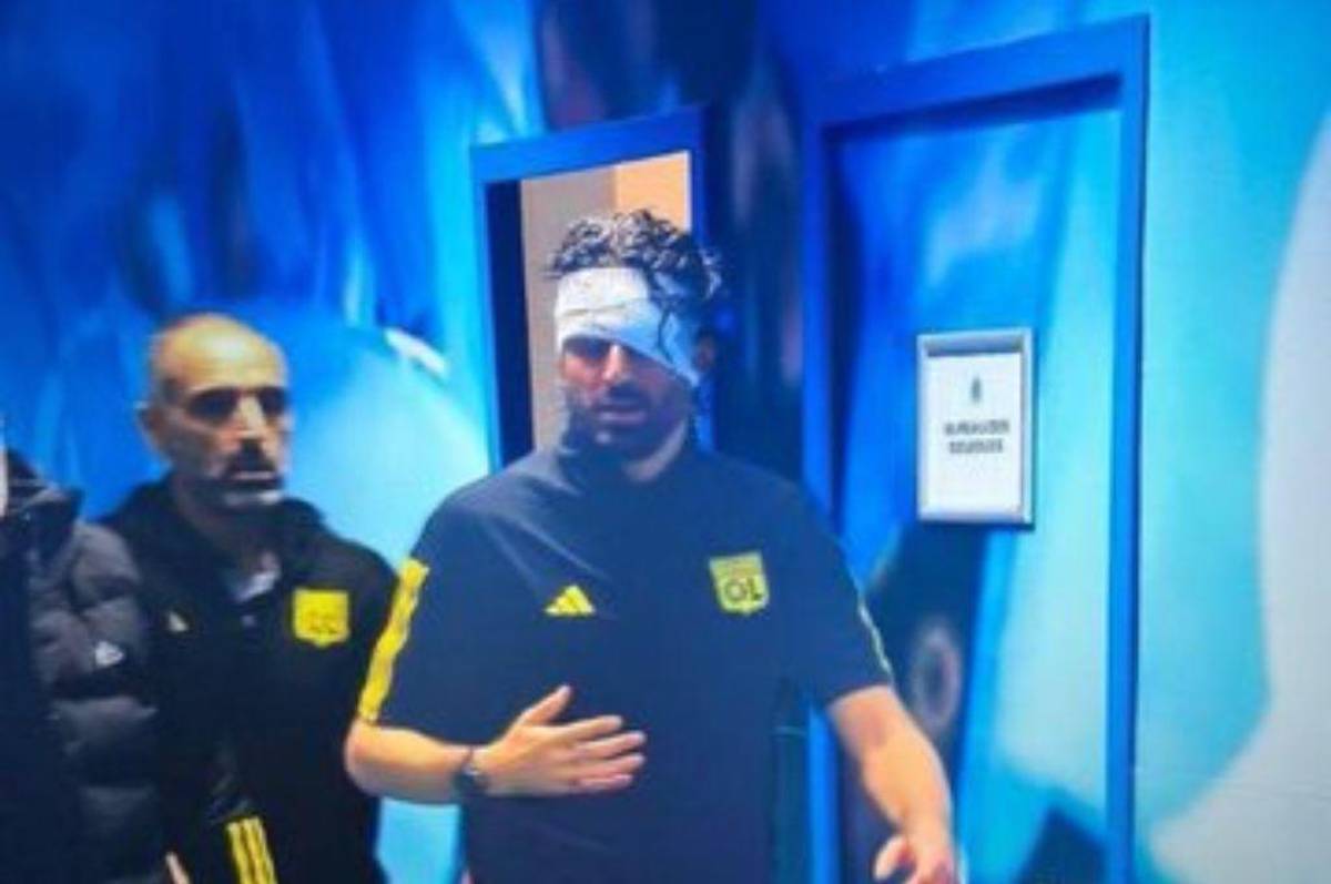 Le destrozaron la cara al entrenador del Lyon: hinchas de Marsella apedrearon el bus y esta ha sido la decisión de la Ligue 1