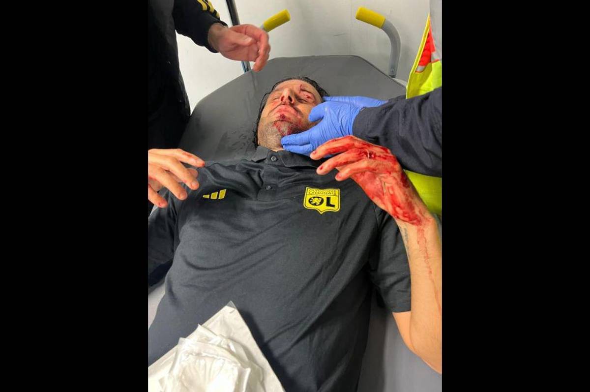 Le destrozaron la cara al entrenador del Lyon: hinchas de Marsella apedrearon el bus y esta ha sido la decisión de la Ligue 1