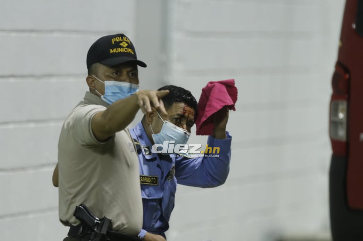 Las fotos del drama en el Morazán: Jhow Benavídez pidiendo calma, policía y aficionados heridos en el Clásico Real España-Marathón
