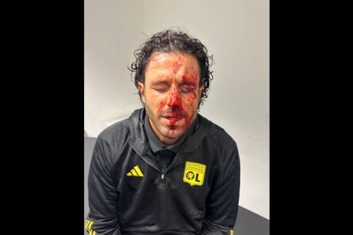 Le destrozaron la cara al entrenador del Lyon: hinchas de Marsella apedrearon el bus y esta ha sido la decisión de la Ligue 1