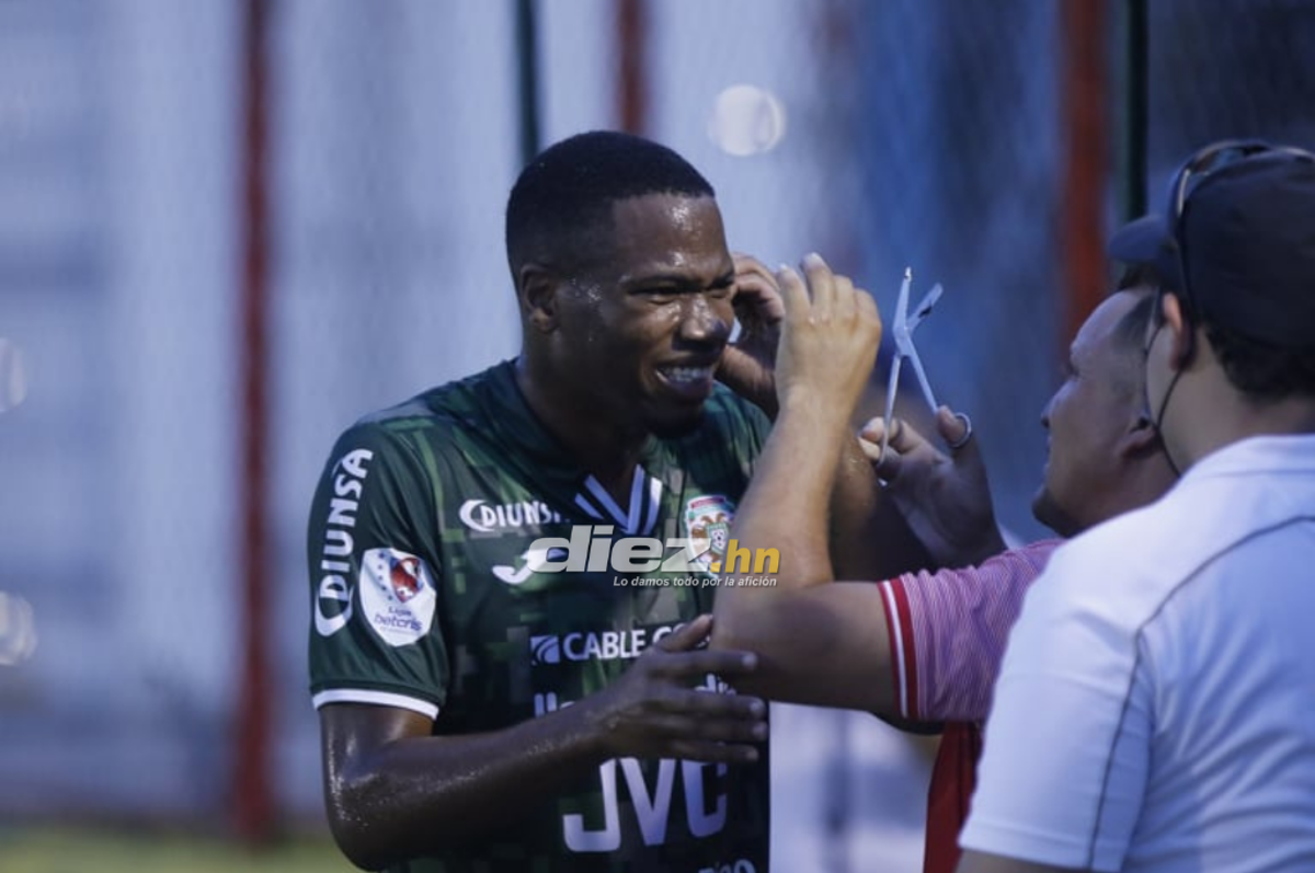 NO SE VIO EN TV: Cortan arito a jugador de Marathón con alicate, la bronca de Mayorquín y el coqueteo de Kevin Álvarez con la hermana de Getsel Montes