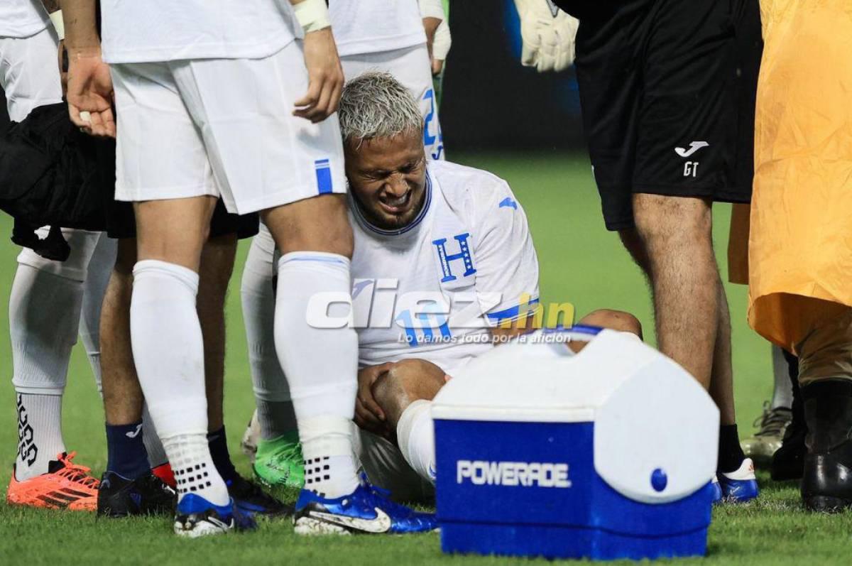 Olancho FC es el más afectado: las bajas confirmadas de Olimpia, Motagua y Real España para las semifinales del Apertura