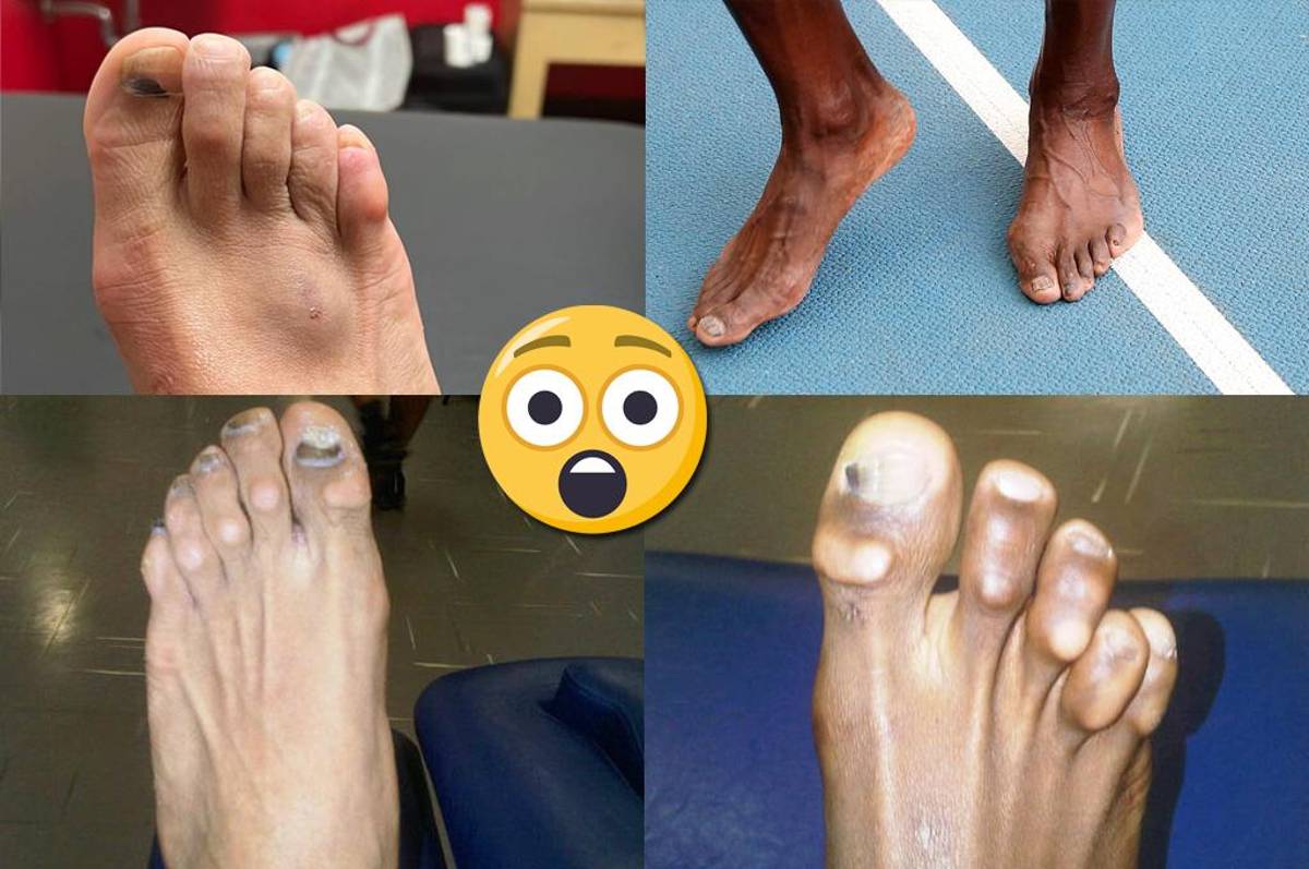 ¡Al descubierto! Así son los pies más feos de algunos deportistas reconocidos a nivel mundial; los de CR7 y Lebron son horribles