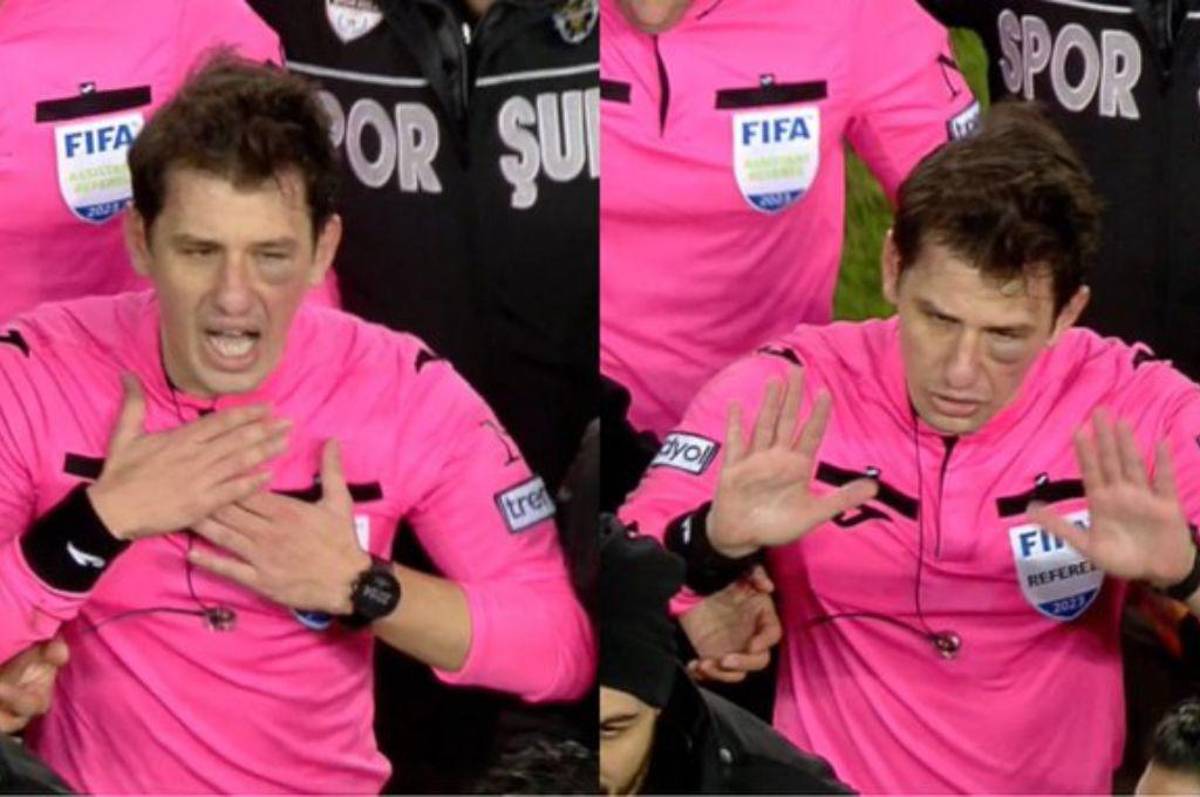 Con el ojo morado y pateado en el suelo: así quedó el árbitro tras ser golpeado por el presidente y jugadores de un equipo turco