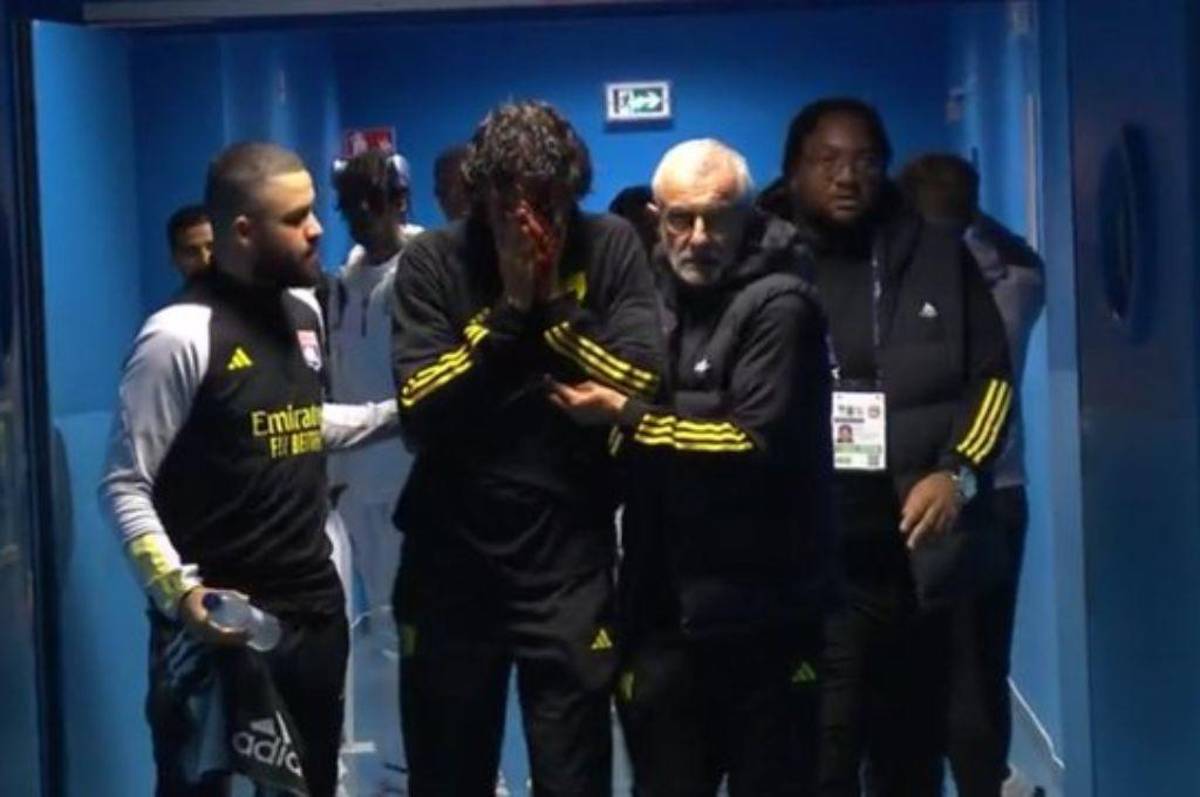 Le destrozaron la cara al entrenador del Lyon: hinchas de Marsella apedrearon el bus y esta ha sido la decisión de la Ligue 1