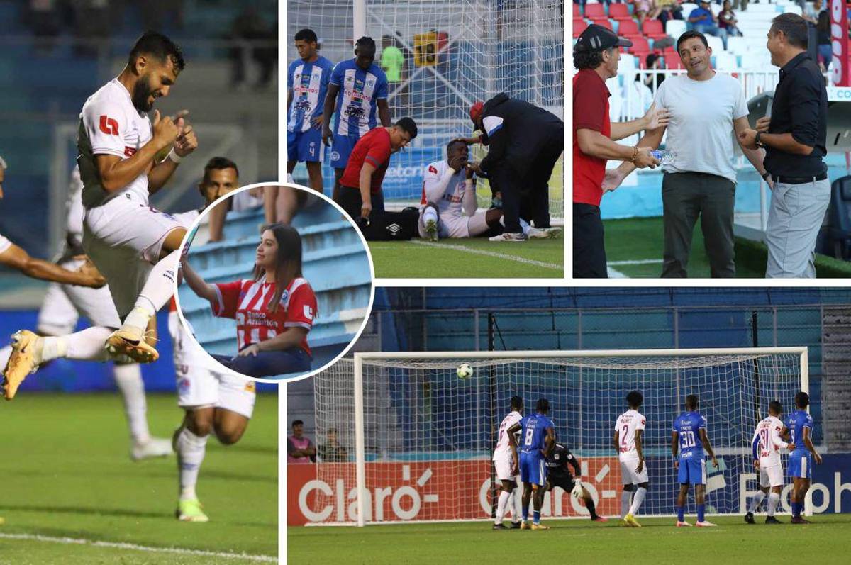 El descartado de Troglio, el duro golpe que recibió Arboleda, la pincelada de Alexy Vega y la belleza que invadió el Chelato Uclés