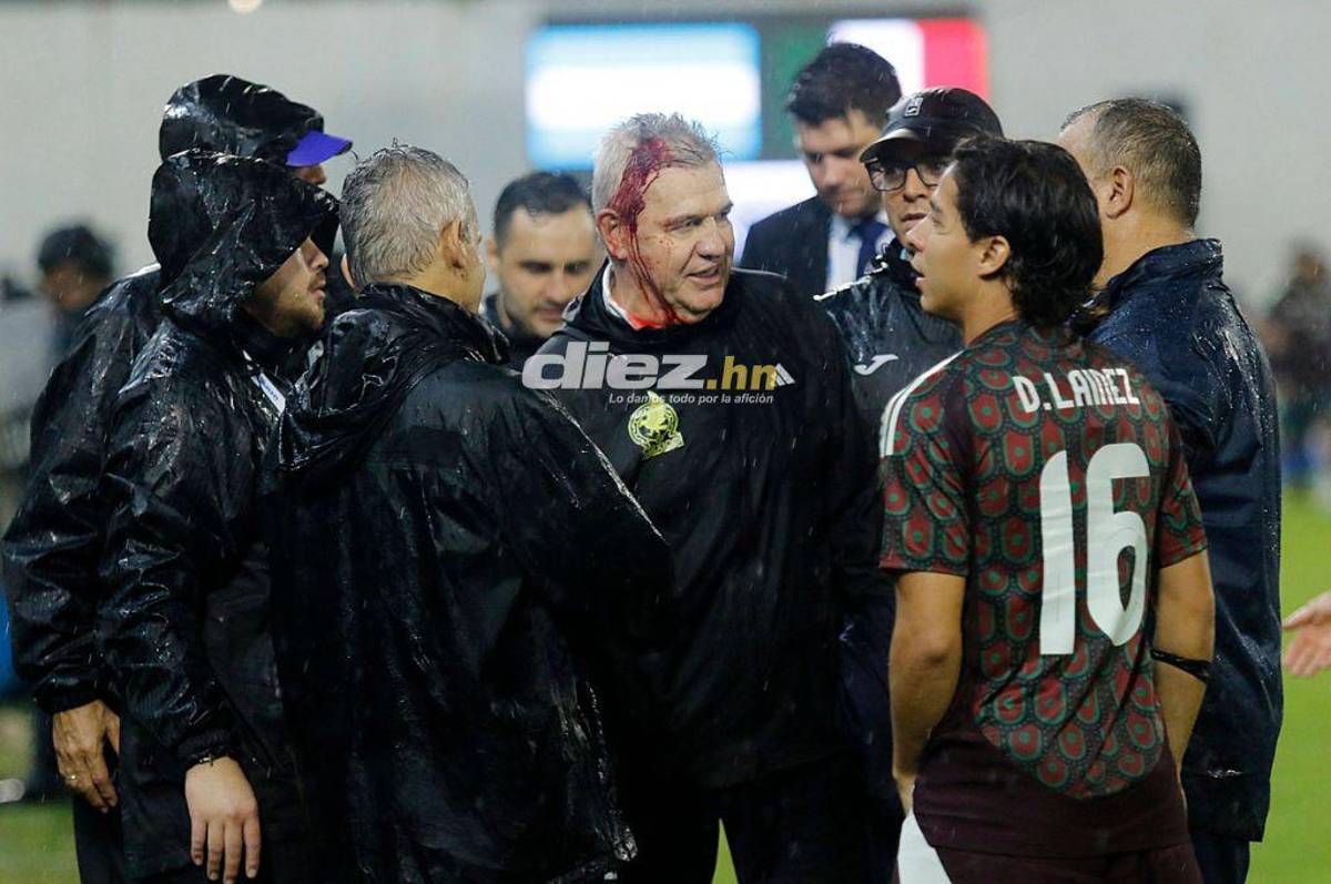 Bronca entre jugadores, el festejo de Honduras tras vencer a México y el feo gesto de Javier Aguirre, quien sufrió un corte en la cabeza