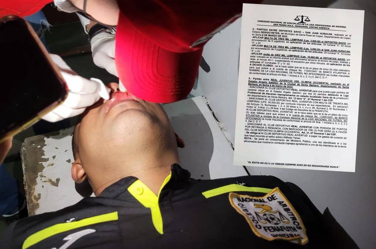 Real Juventud recibe multa de L 30 mil, pérdida de puntos y suspensión de cancha por agresión a árbitro asistente