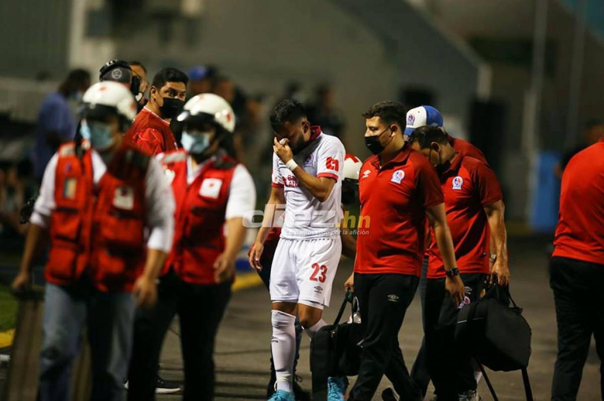 ¡Olimpia pierde a Jorge Álvarez por dos semanas tras sufrir una fractura en su nariz!