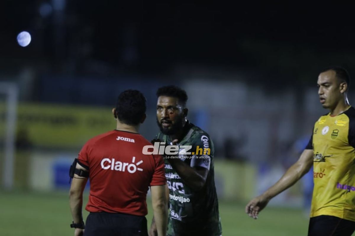 NO SE VIO EN TV: Cortan arito a jugador de Marathón con alicate, la bronca de Mayorquín y el coqueteo de Kevin Álvarez con la hermana de Getsel Montes