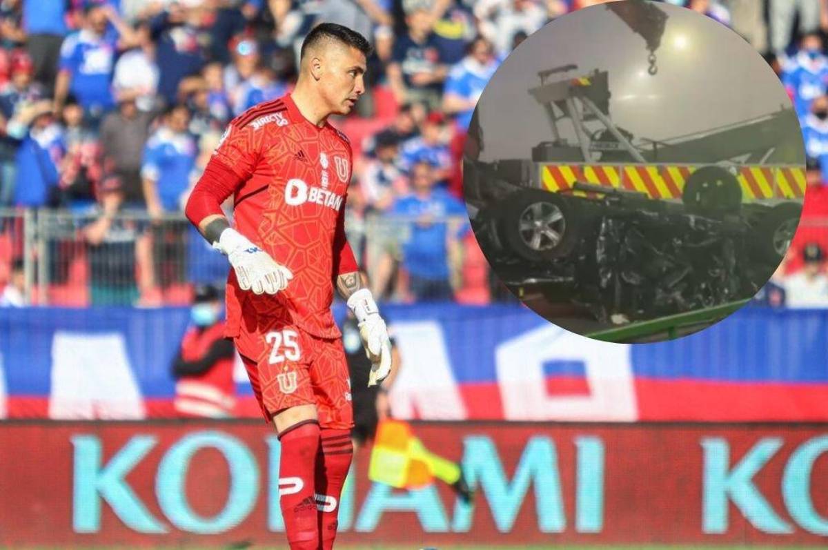 Arquero chileno sufre amputación del pie en accidente y médicos toman una delicada decisión