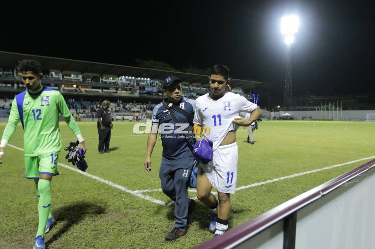 No se vio en TV: Las duras imágenes de los jugadores de Honduras, Luis Alvarado destrozado y el gesto de los estadounidenses