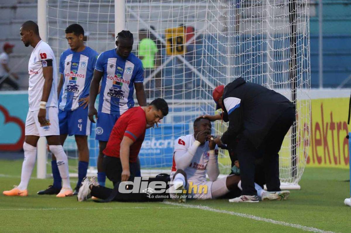 El descartado de Troglio, el duro golpe que recibió Arboleda, la pincelada de Alexy Vega y la belleza que invadió el Chelato Uclés