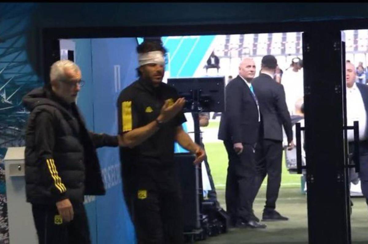 Le destrozaron la cara al entrenador del Lyon: hinchas de Marsella apedrearon el bus y esta ha sido la decisión de la Ligue 1