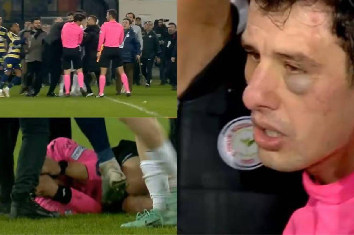 Con el ojo morado y pateado en el suelo: así quedó el árbitro tras ser golpeado por el presidente y jugadores de un equipo turco