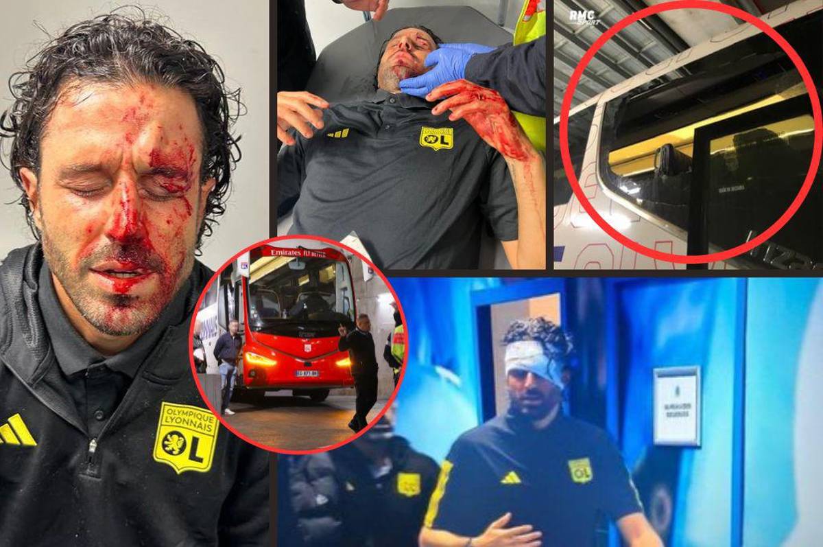 Le destrozaron la cara al entrenador del Lyon: hinchas de Marsella apedrearon el bus y esta ha sido la decisión de la Ligue 1