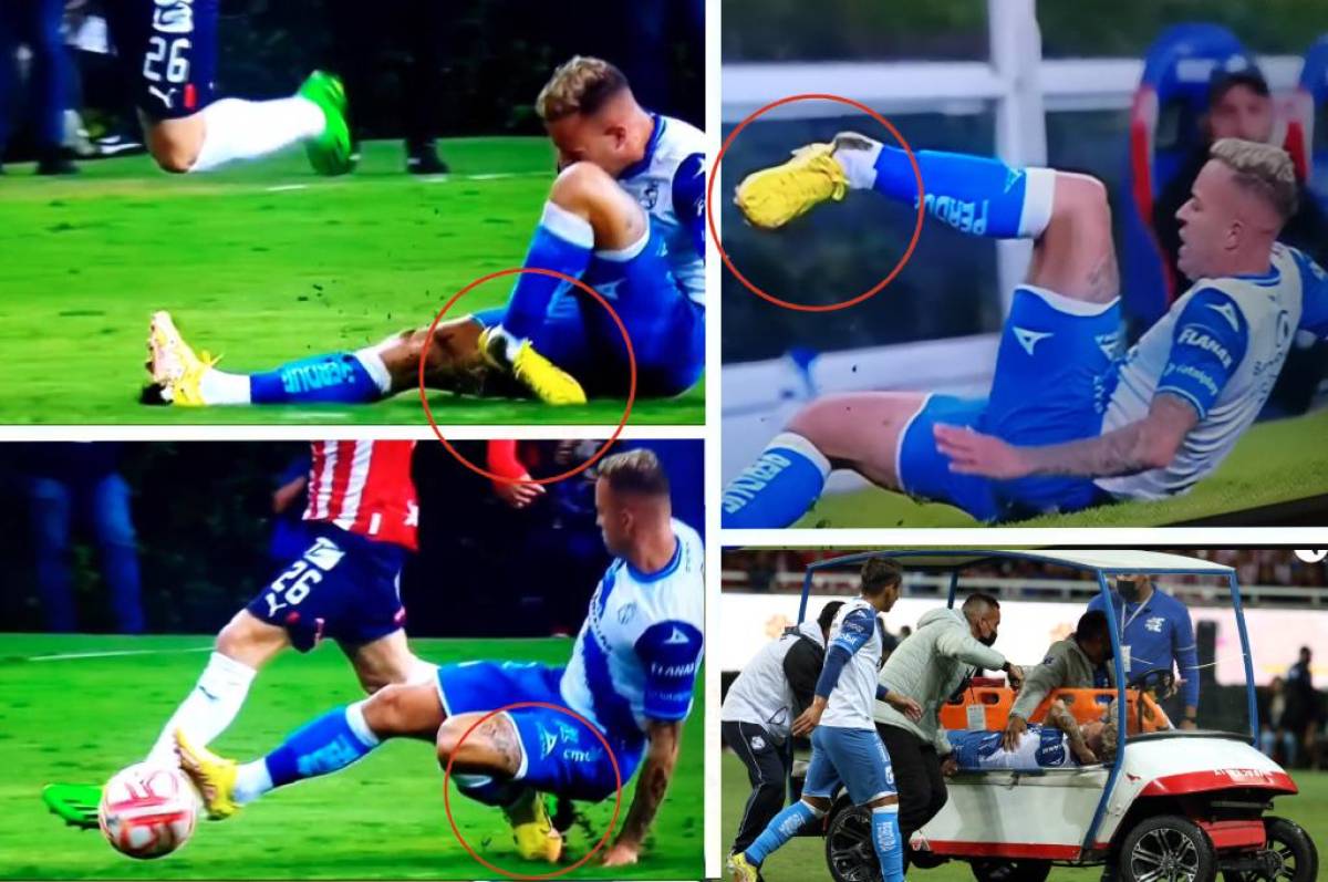 ¡Fuertes imágenes! La espeluznante lesión en la Liga MX: jugador del Puebla se deshace tobillo en desafortunada entrada