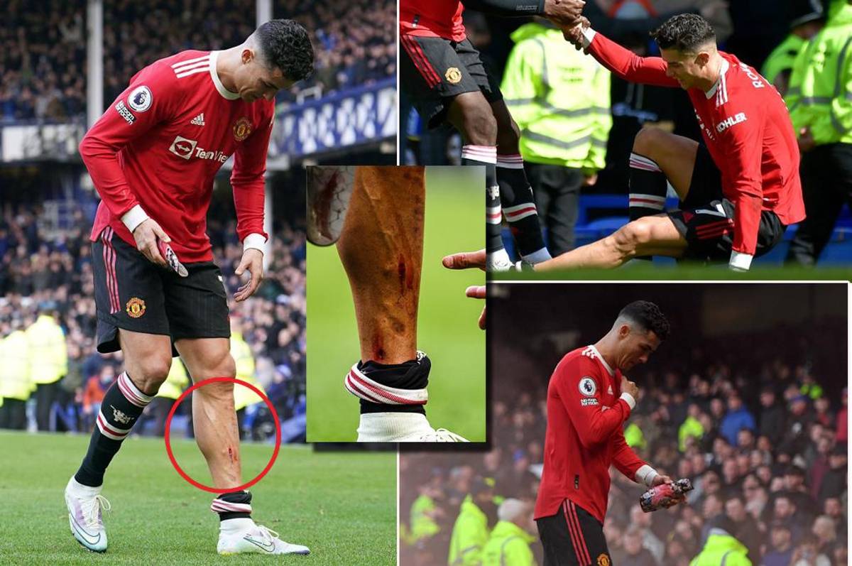 Escalofriante: así le quedó la pierna a Cristiano Ronaldo en la dolorosa derrota del Manchester United
