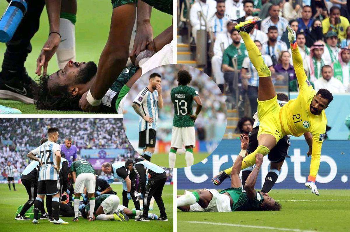 ¡Impactante momento! Confirman alcance de la lesión de Al Shahrani, jugador de Arabia Saudí tras vencer a Argentina