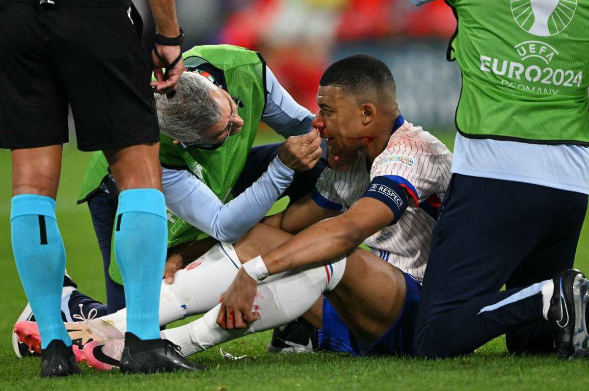 Mbappé se rompe, dardo de MisterChip a Kylian y Griezmann terminó lleno de sangre en el debut de Francia en la Eurocopa