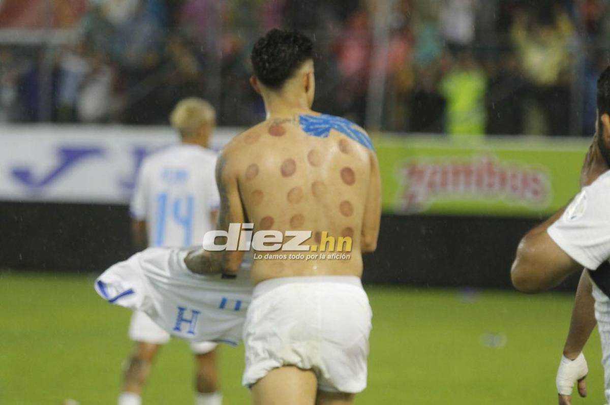 Bronca entre jugadores, el festejo de Honduras tras vencer a México y el feo gesto de Javier Aguirre, quien sufrió un corte en la cabeza