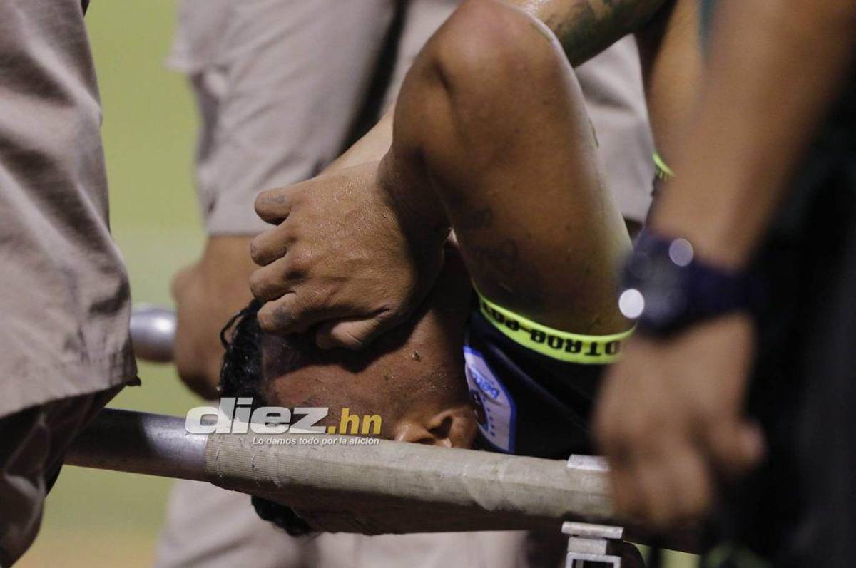 No se vio en TV: El sufrimiento de Mario Martínez, la frustración en Real España y la fiesta de los Potros en el Olímpico