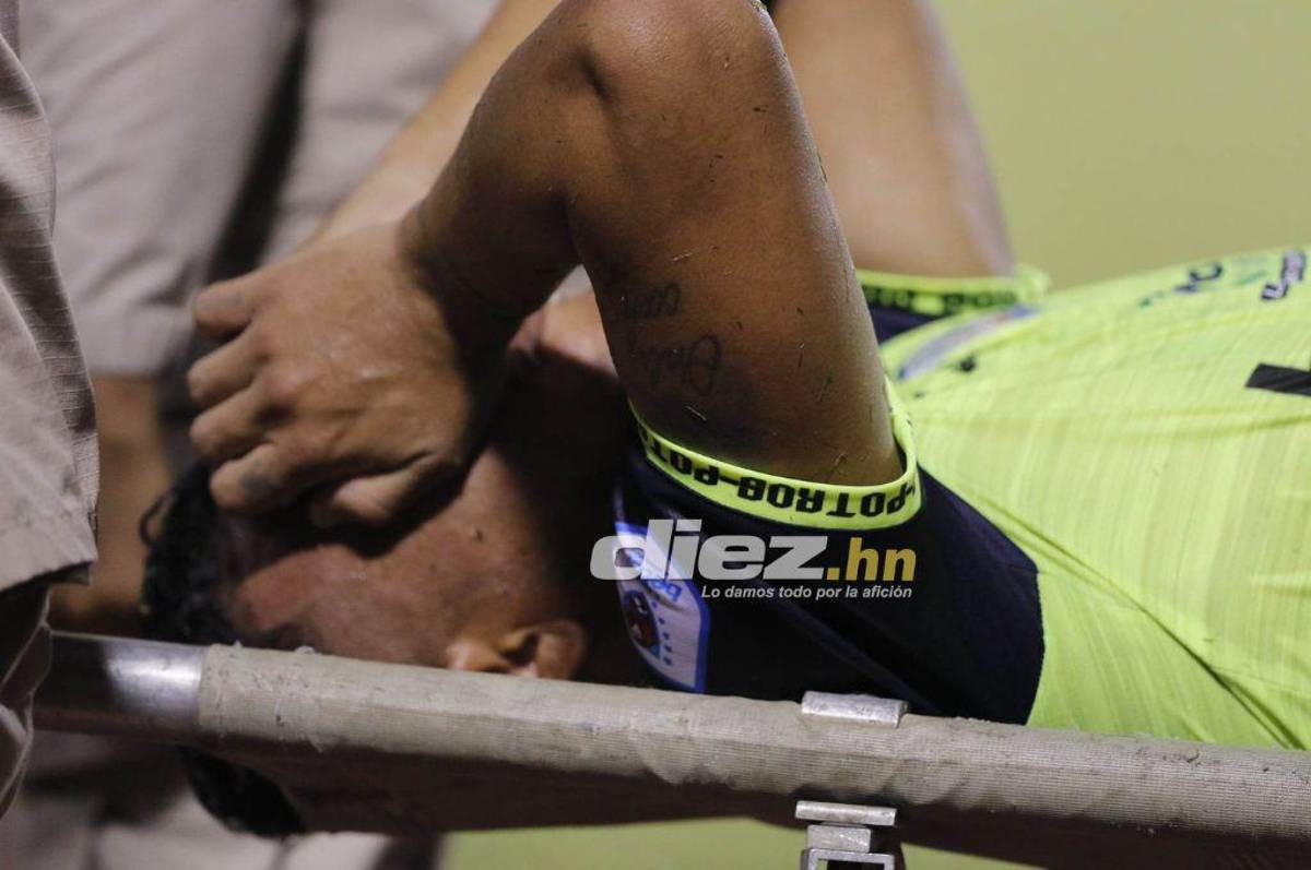 No se vio en TV: El sufrimiento de Mario Martínez, la frustración en Real España y la fiesta de los Potros en el Olímpico