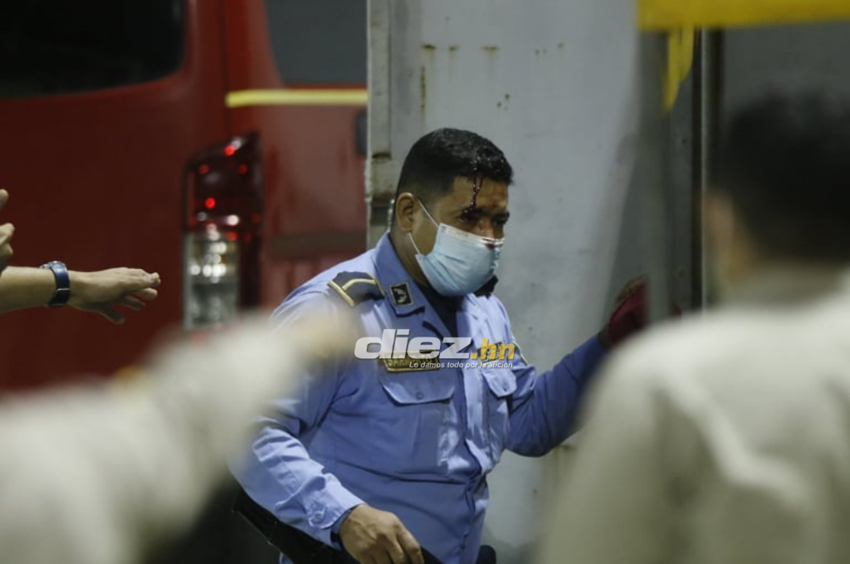 Las fotos del drama en el Morazán: Jhow Benavídez pidiendo calma, policía y aficionados heridos en el Clásico Real España-Marathón