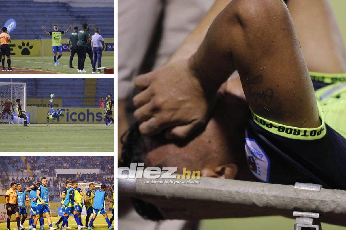 No se vio en TV: El sufrimiento de Mario Martínez, la frustración en Real España y la fiesta de los Potros en el Olímpico