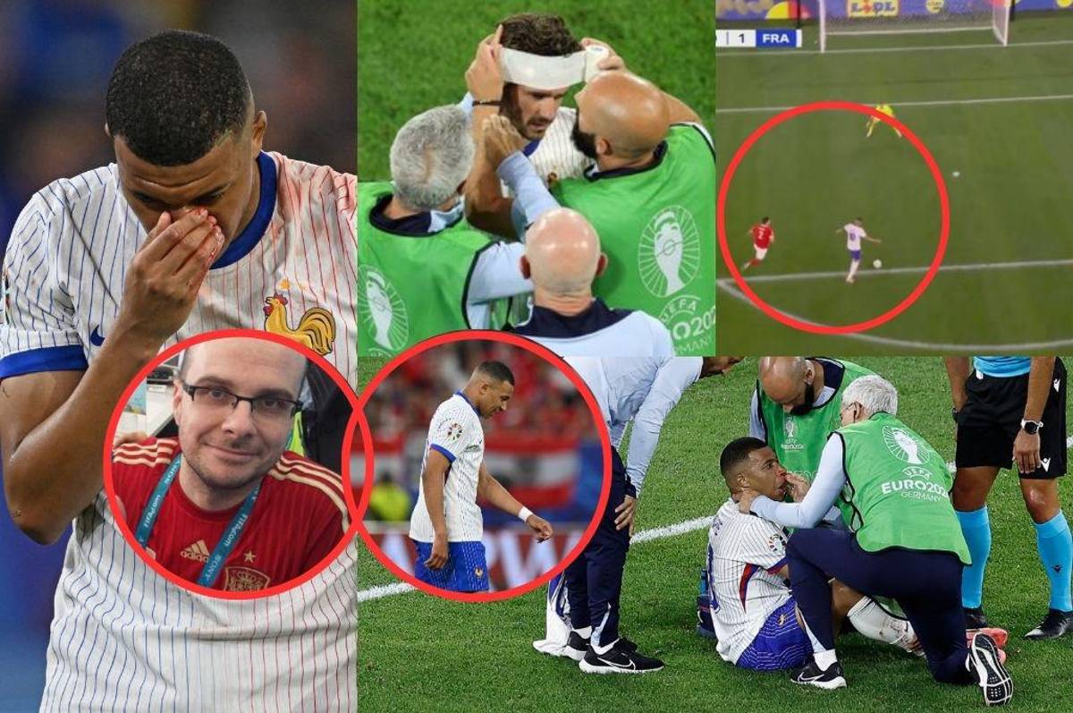 Mbappé se rompe, dardo de MisterChip a Kylian y Griezmann terminó lleno de sangre en el debut de Francia en la Eurocopa